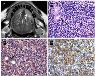 Lymphoma of the Sublingual Gland: Clinical, Morphological, Histopathological, and Genetic Characterization